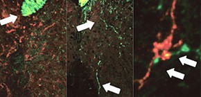 Mechanism of spontaneous recovery from CNS damage in MS discovered
