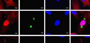Clarification of how Toxoplasma gondii manipulates host immune response to increase parasite virulence