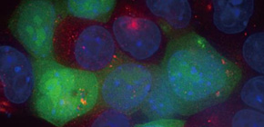 Successful development of a method for efficiently delivering foreign DNA to living cells