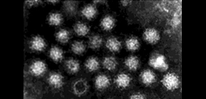 Going viral: New cells for norovirus production in the lab