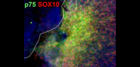 Eye-Opening Study Differentiates iPS Cells into Various Ocular Lineages