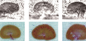 糖尿病による腎障害の画像化に成功