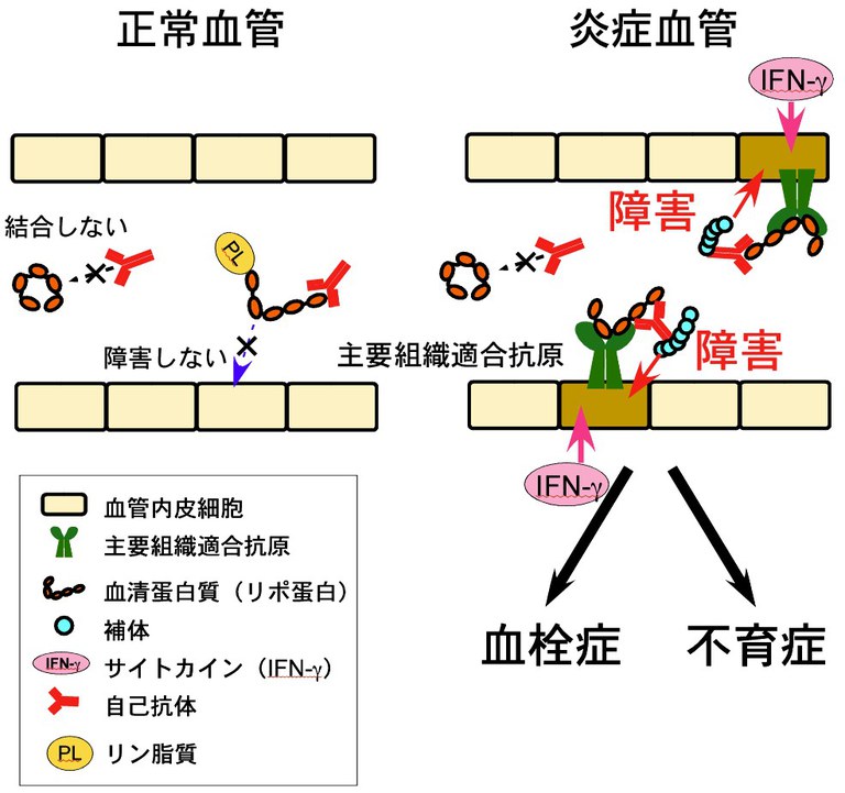 20150303_1_fig5.jpg