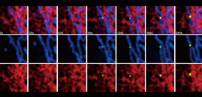 Formation site of autophagosomal membranes identified