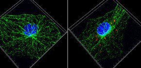 Mechanism for alleviating gout inflammation clarified 