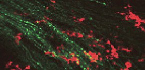 Highlighting the role of immune cells in the survival of motor neurons in the brain