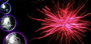 Elucidation of the mechanism behind amyloid fibrils and development of diseases such as Alzheimer's and Parkinson's diseases