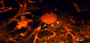 Olfactory Plays a Key Role in Spatiotemporal Pathogenesis of Cerebral Malaria