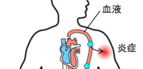 A mechanism for immune regulation by the nervous system