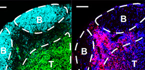 Immune cells for suppressing the deterioration of multiple sclerosis identified