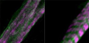 Recovering Lost Skeletal Muscle Function by Using Light Pulses
