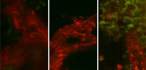 Smallest Nucleic Acid Medicine Delivery System Developed 