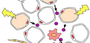 Molecule Causing Obesity-associated Chronic  Inflammation Identified