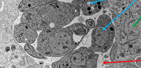 Key findings to develop a vaccine against Toxoplasma