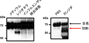 Discovery of a new biological defense system to eliminate microbial pathogens