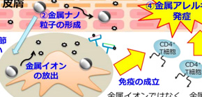 Mouse models for examining the cause of metal allergy established, a world first