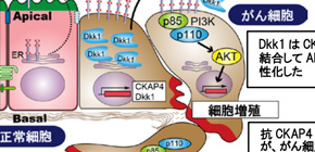 Proteins promoting pancreatic and lung cancers with a high mortality rate discovered