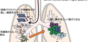  Interleukin-1α causes people to choke on air 