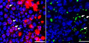 Therapeutic targets that ALS and SCA31 have in common identified