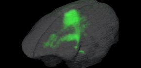 High-speed whole-brain imaging improves understanding of brain disease in animals and humans