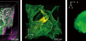 Superior pathological diagnosis using transparent tissues