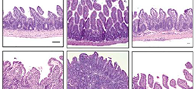 CD4 T Cells, Xenobiotic Transporters, and Metabolites in Inflammatory Bowel Diseases