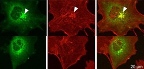 Mechanism of familial Parkinson’s disease clarified in fruit fly model