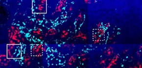 Clarifying the interplay between bone cells in bone remodeling