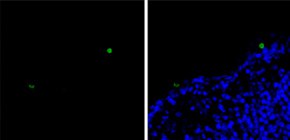 Helpful B cells lend a hand to developing neurons 