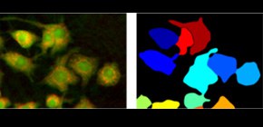 Multiple optical measurements reveal the single cell activation without contrast agent