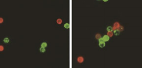 Cholesterol leash: key tethering protein found to transport cellular cholesterol