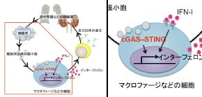 Step-by-Step Account of Systemic Lupus Erythematosus Development Revealed