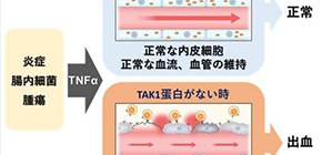 Resist! TAK1 enables endothelial cells to avoid apoptosis