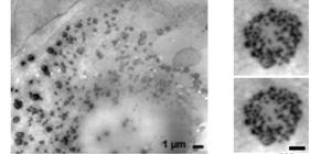 New microscopic technique clarifies early stage of osteogenesis