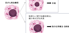 Lymph nodes can predict survival in patients with esophageal cancer