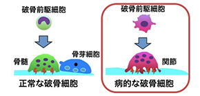 Researchers split the “AtoM” in search of a treatment for rheumatoid arthritis