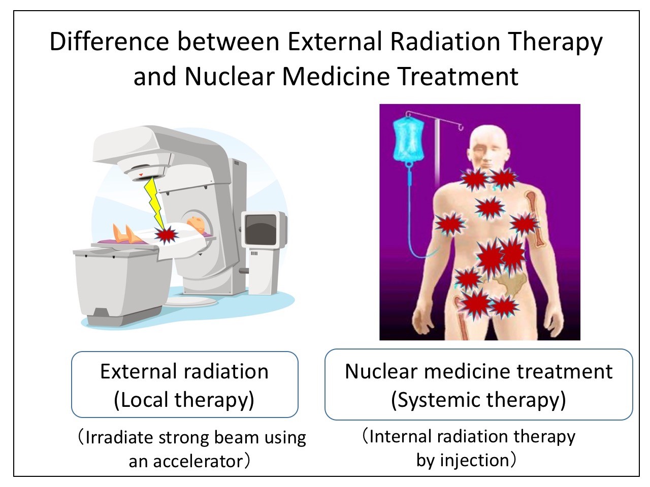 Breakthrough alpharay treatment of cancer without external radiation