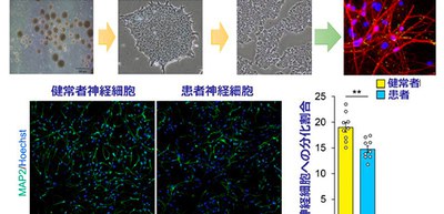 Scientists clarify how genetic mutations cause abnormalities in brain development and sociality