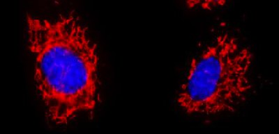 Mitochondrial fission factor plays an important role in mitochondrial antiviral signaling-mediated innate immunity