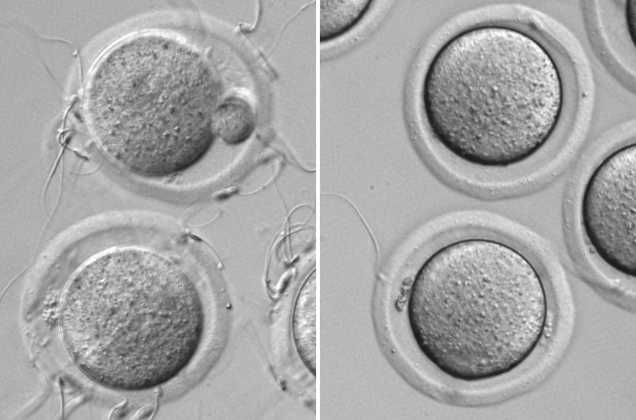 Novel Switch Protein That ‘turns On Sperm For Fertilization Resou