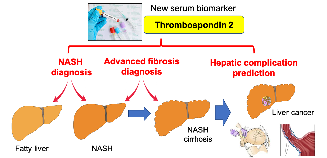 A simple blood test to identify patients at risk of nonalcoholic fatty liver disease