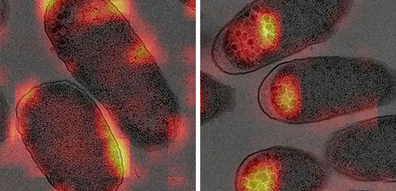 Drug-resistant bacteria flaunt their curves