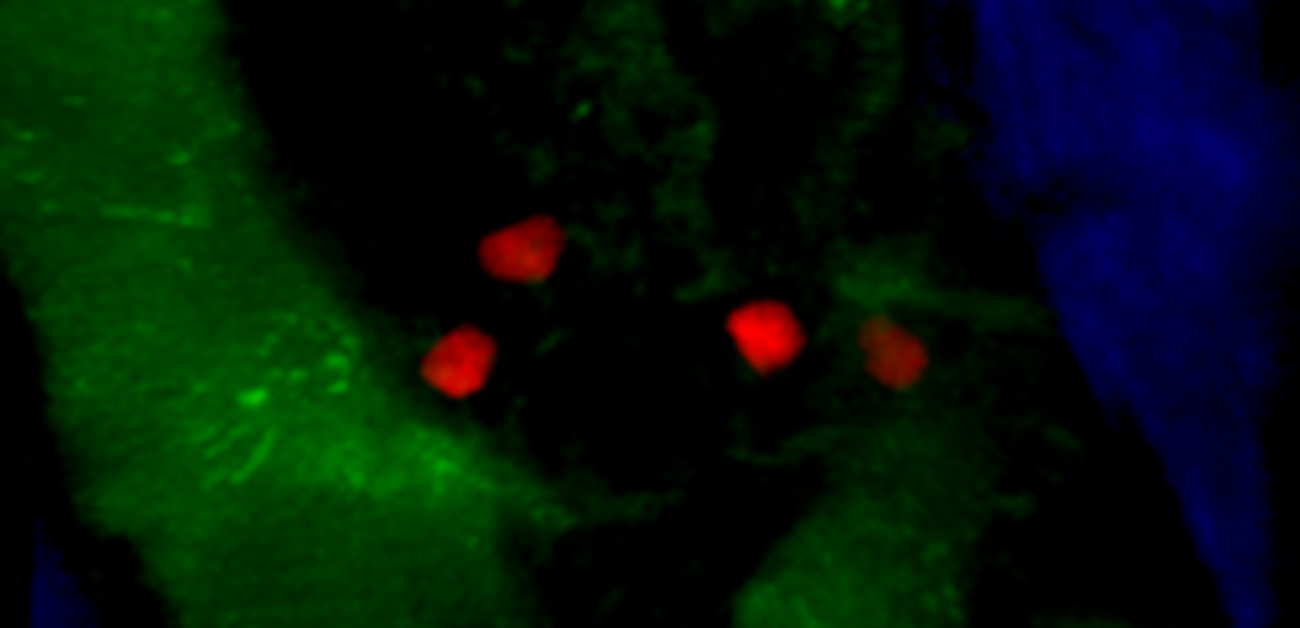 Tracking plasma cell survival