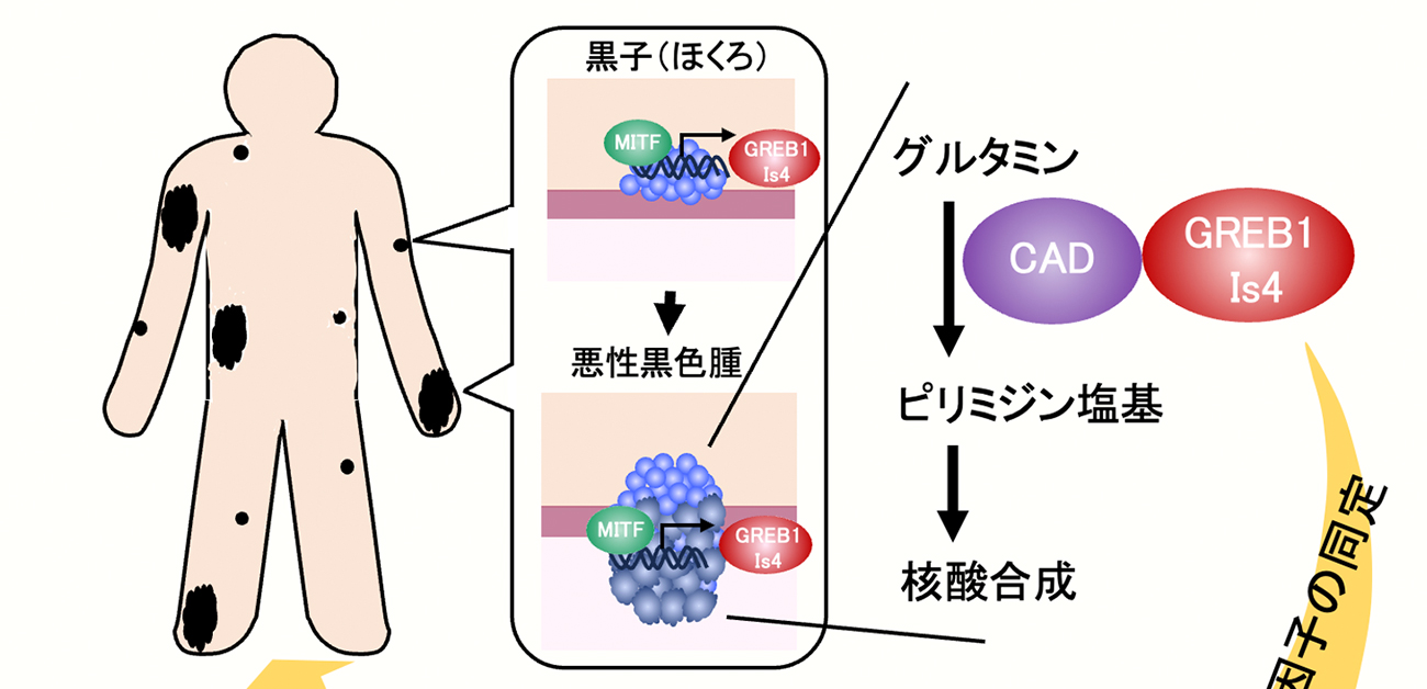 New insights into melanoma development and therapy