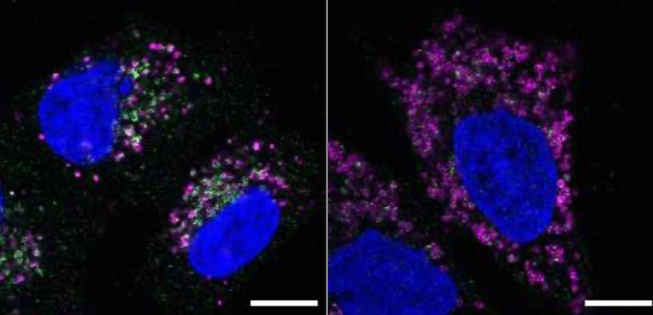 Microautophagy is essential for preventing aging