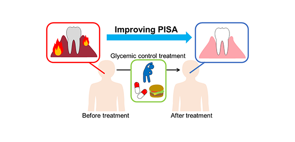 Getting to the root of the problem: Intensive diabetes treatment reduces gum disease inflammation