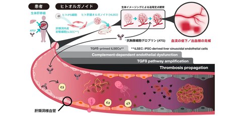 Elucidated mechanism of vascular impairment caused by immunosuppressive agent by using human iPSC-derived vascularized liver organoids