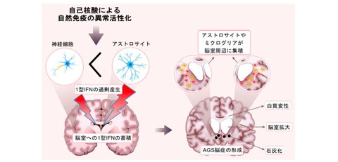 Elucidated the mechanism of encephalopathy caused by interferon overproduction