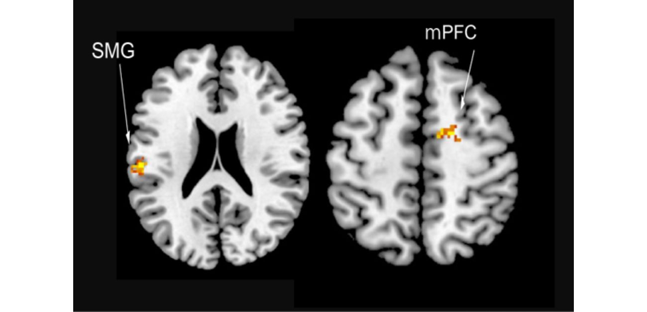 Rivalries shape social maps in the brain