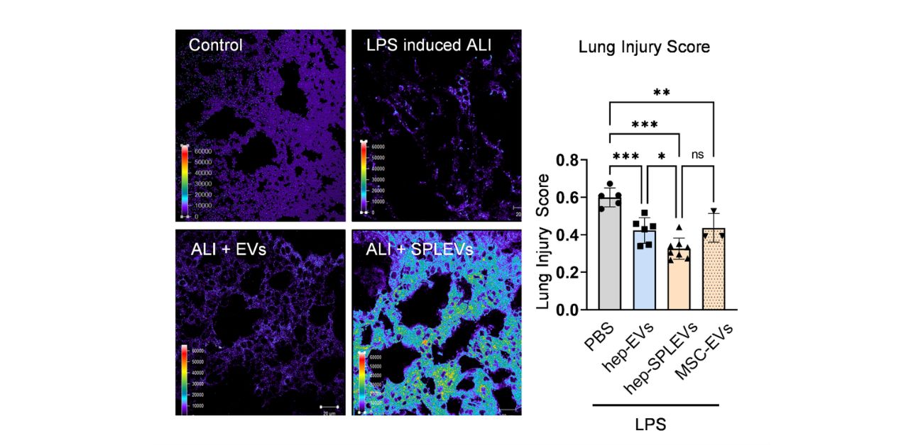 Weathering a cytokine storm with extracellular vesicles